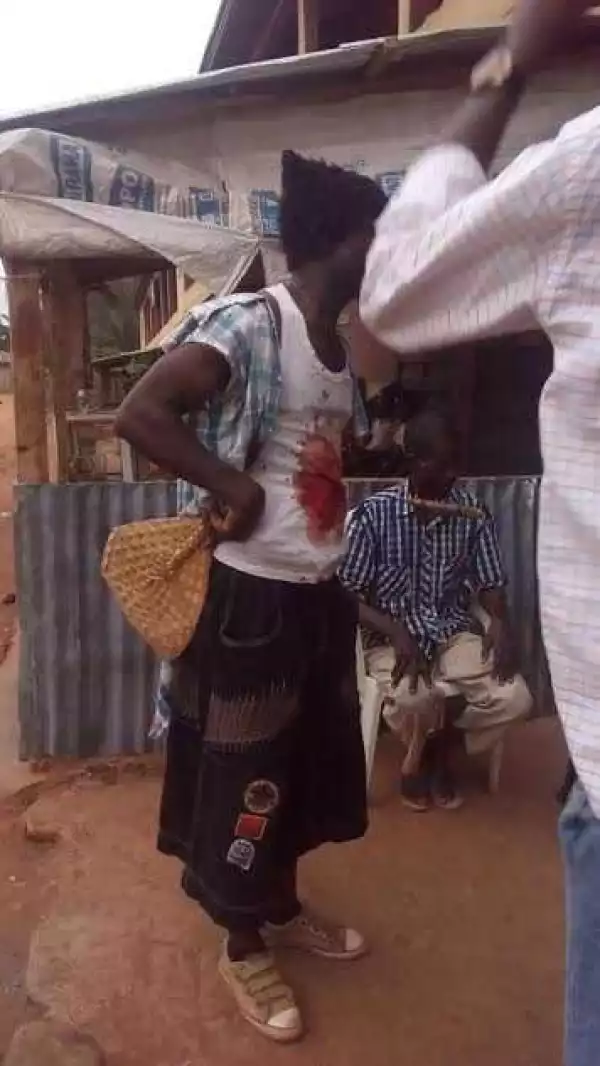 Man Spotted Roaming The Street With Knife In His Stomach In Imo State (Photos)